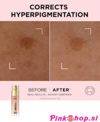 L'Oréal Paris Age Perfect Golden Age Rapid Spot, korektor proti pigmentnim madežem, Pinkshop.si
