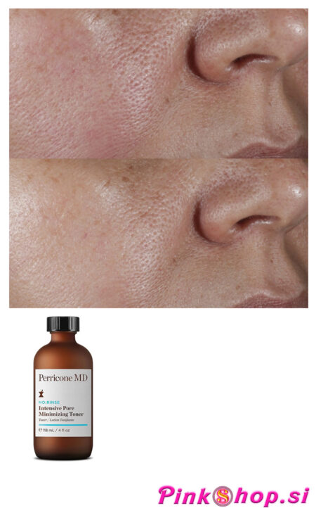Perricone MD No:Rinse Intensive Pore Minimizing Toner, intenzivni tonik za zmanjšanje por, Pinkshop.si